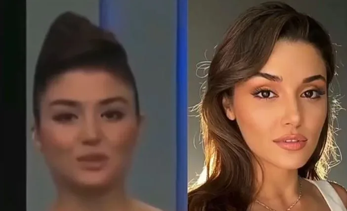 L’incredibile cambiamento di Hande Erçel è tornato all’ordine del giorno sui social media!