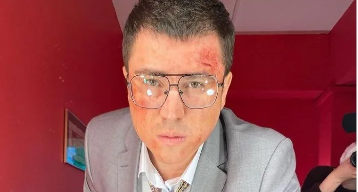 La serie era molto popolare, İbrahim Büyükak ha preso una nuova decisione!